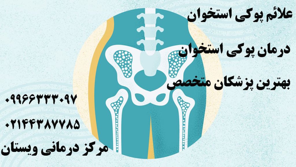 اسکلت بدن انسان برای نمایش پوکی استخوان
