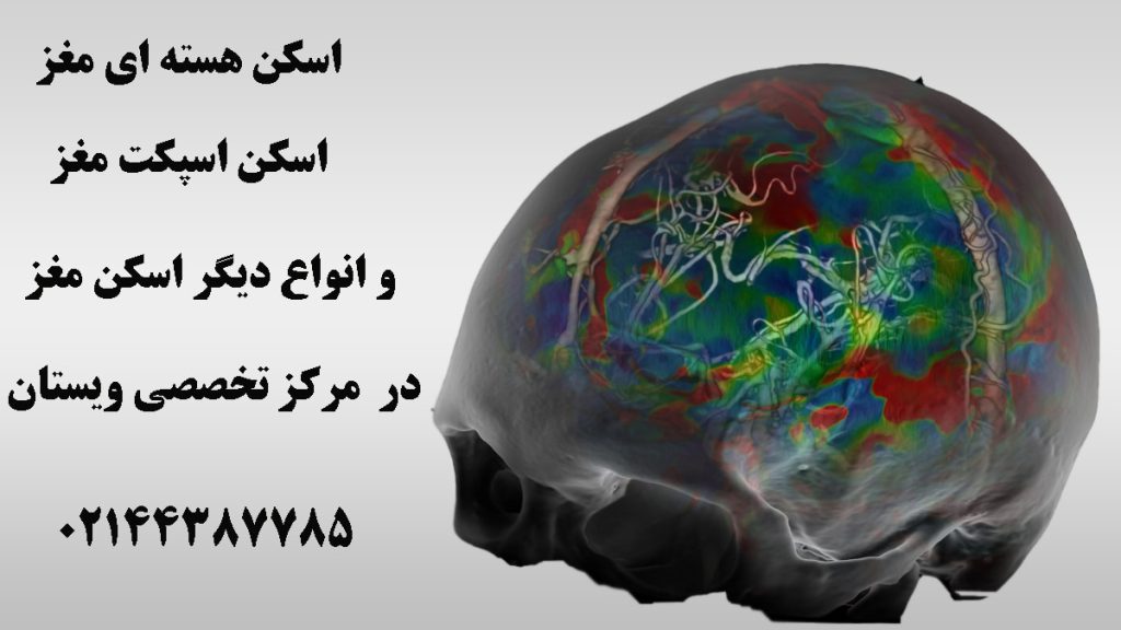 تصویر اسکن هسته ای از مغز