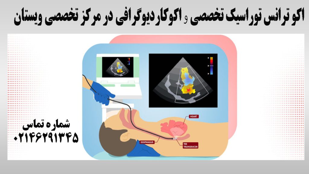 اکو ترانس توراسیک روی یک شخص انجام می شود