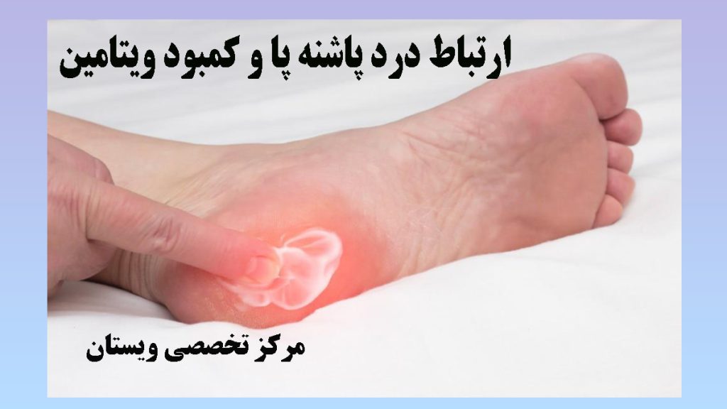درد در قسمت استخوان پاشنه پا نشان داده شده است