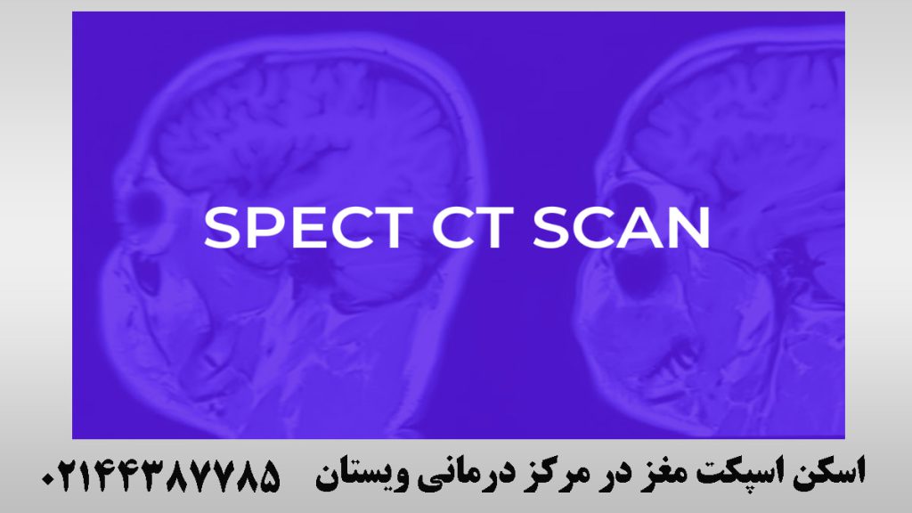 اسکن مغز درر پس زمینه آبی-نوشته : اسکن اسپکت مغز