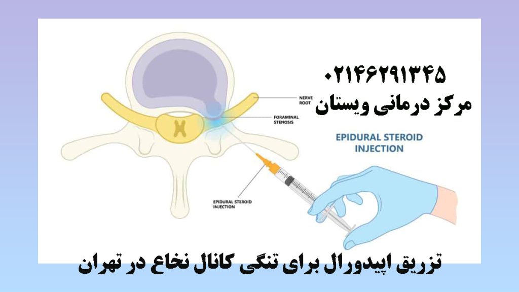 تزریق به مهره های کمر - تصویر انیمیشنی