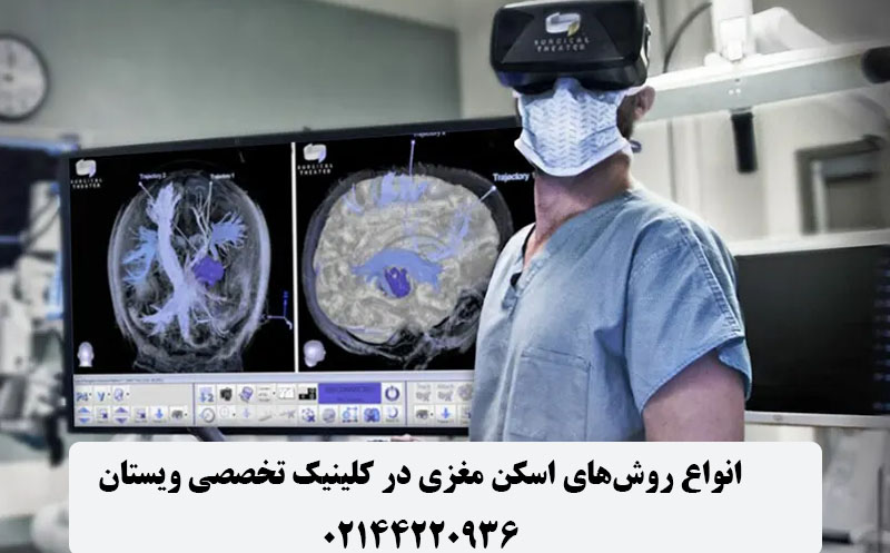 اسکن مغزی چیست و انواع روش های سی تی اسکن مغز