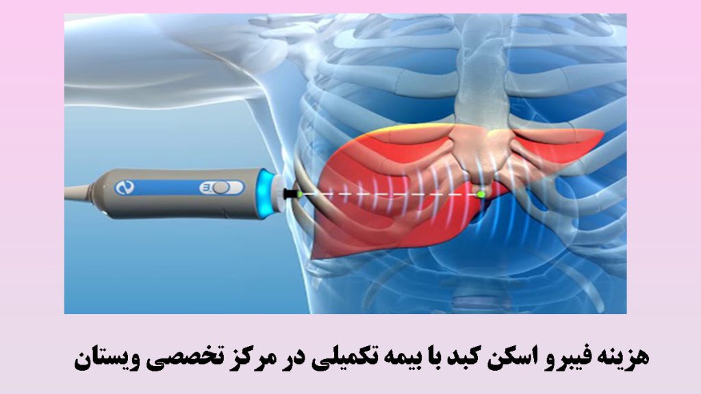 انجام فیبرو اسکن کبد به صورت نمایشی برای آموزش