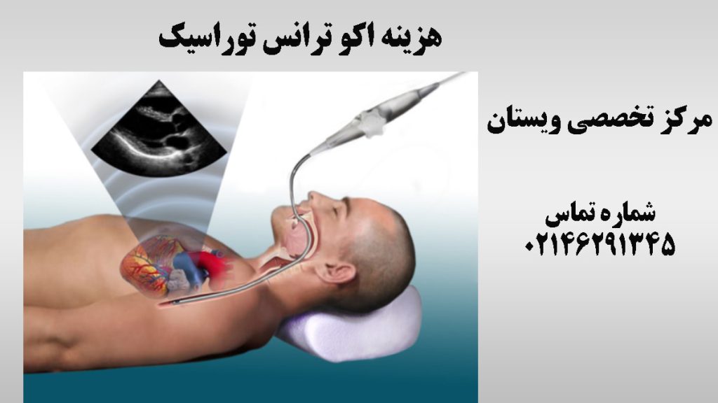 تصویر انیمیشینی از اکو ترانس توراسیک