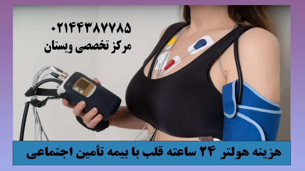 یک خانم که هولتر قلب به قفسه سینه او وصل است و دستگاه هولتر را در دست دارد
