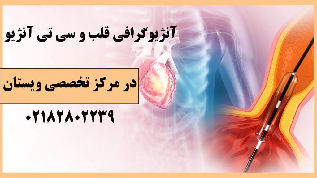 تصویر از آنژیو رگ قلبی
