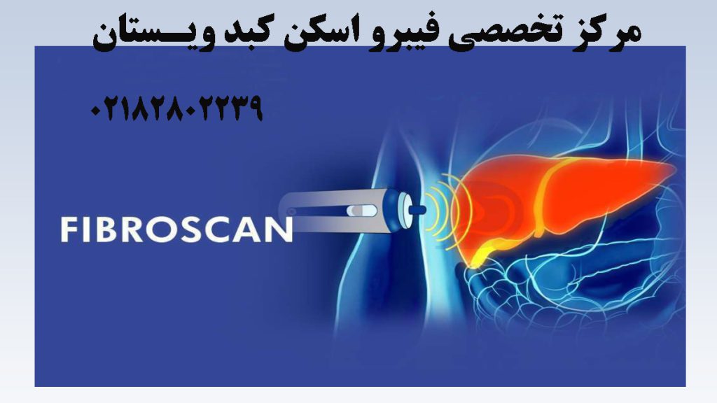 تصویر دیجیتالی از فیبرو اسکن کبد