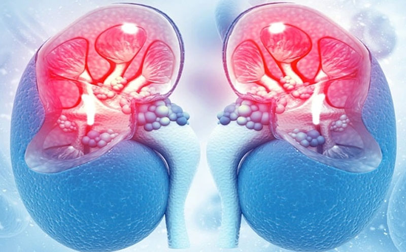 ترجمه جواب سی تی اسکن کلیه