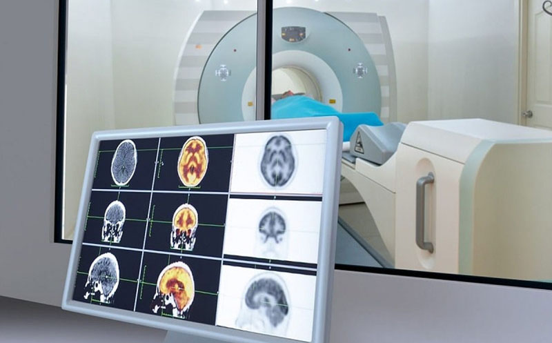 بهترین مرکز اسکن هسته ای ویستان تهران