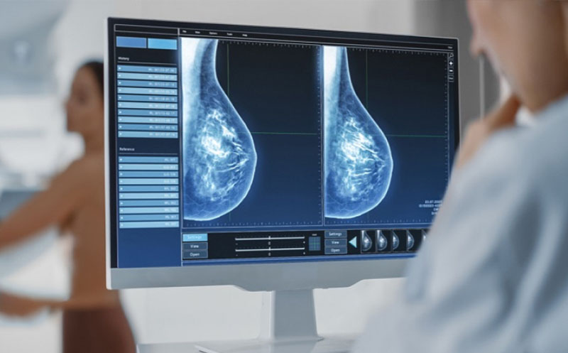 ماموگرافی در تهران، پزشک در حال انجام ماموگرافی