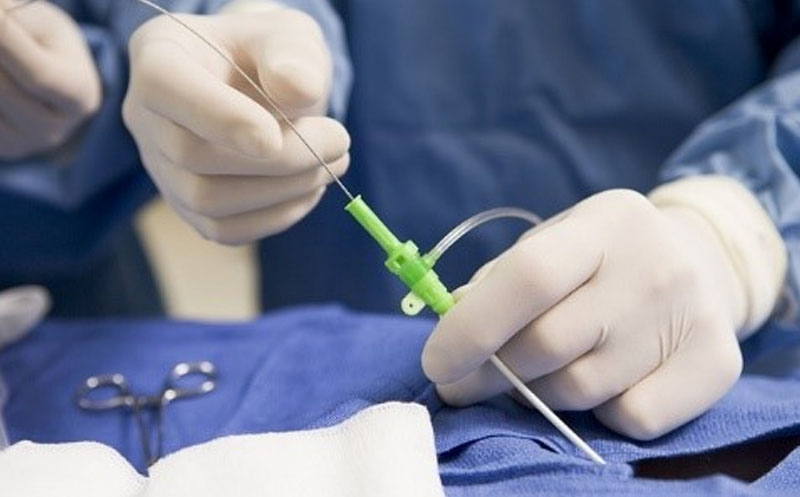 آمادگی قبل از سی تی آنژیو قلب