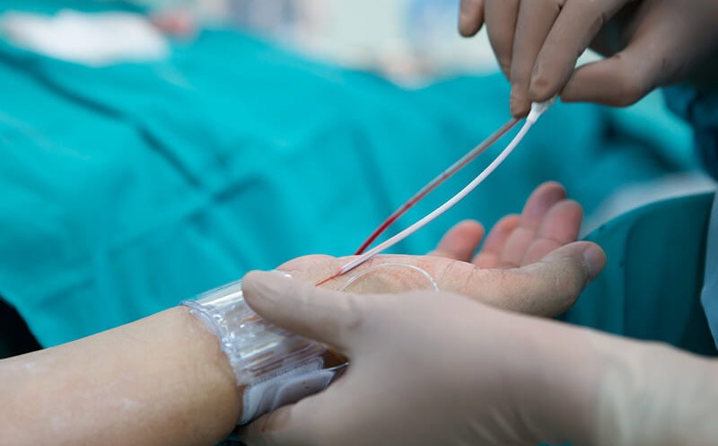 نحوه انجام سی تی آنژیوگرافی قلب