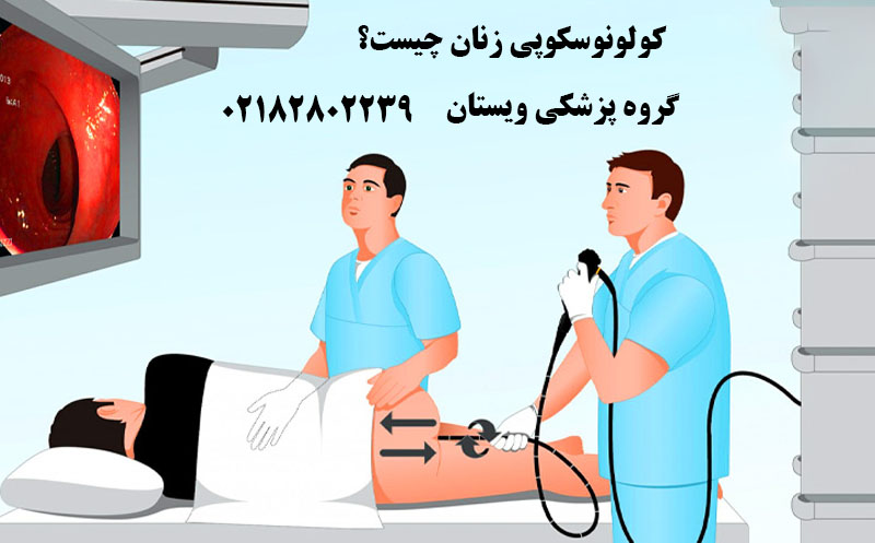 کولونوسکوپی زنان چیست