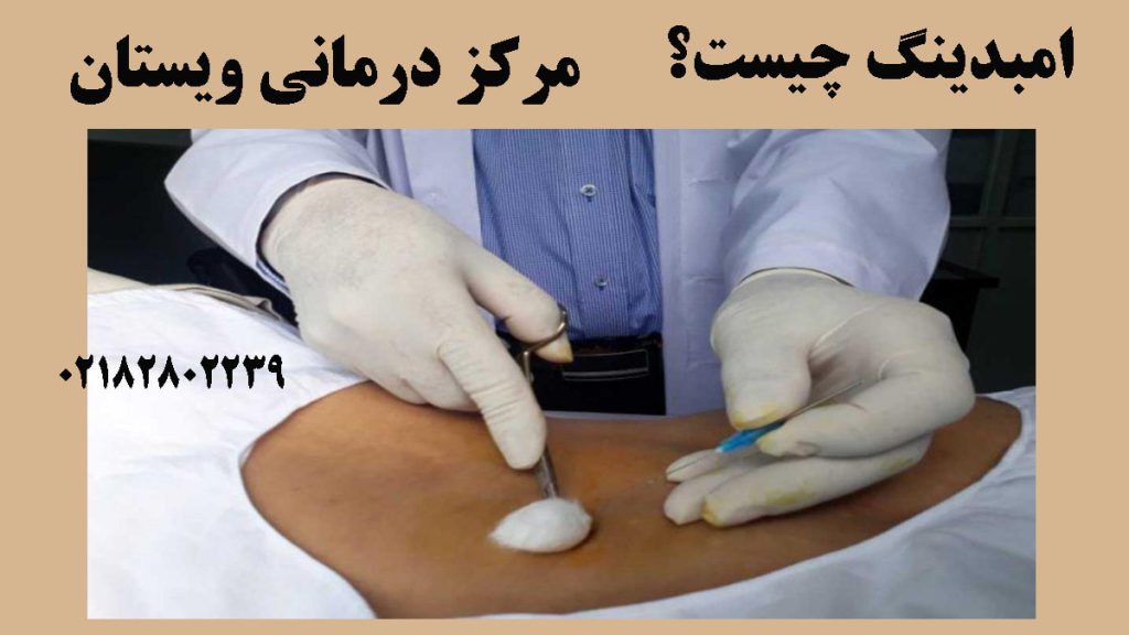 یک پزشک در حال کاشت نخ لاغری- نوشته : امبدینگ چیست؟