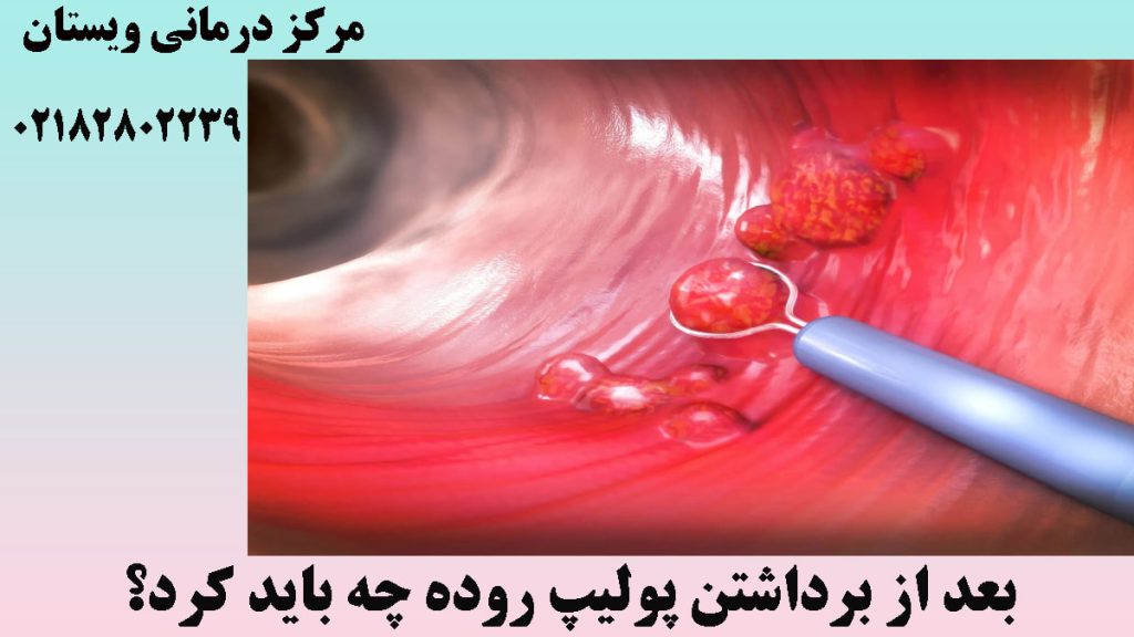 تصویر داخل روده و دستگاه کولونوسکوپی داخل آن