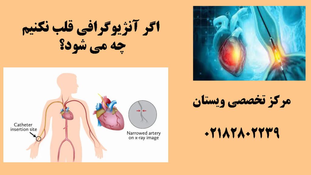 دو تصویر از آنژیو قلب در یک قاب-نووشته : اگر آنژیو نکنیم چه میشود؟