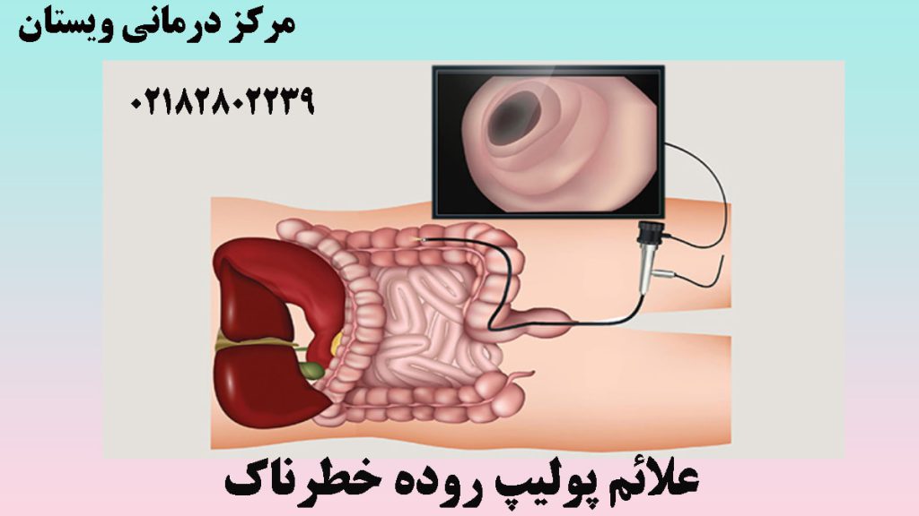 تصویر انیمیشنی از کولونوسکوپی