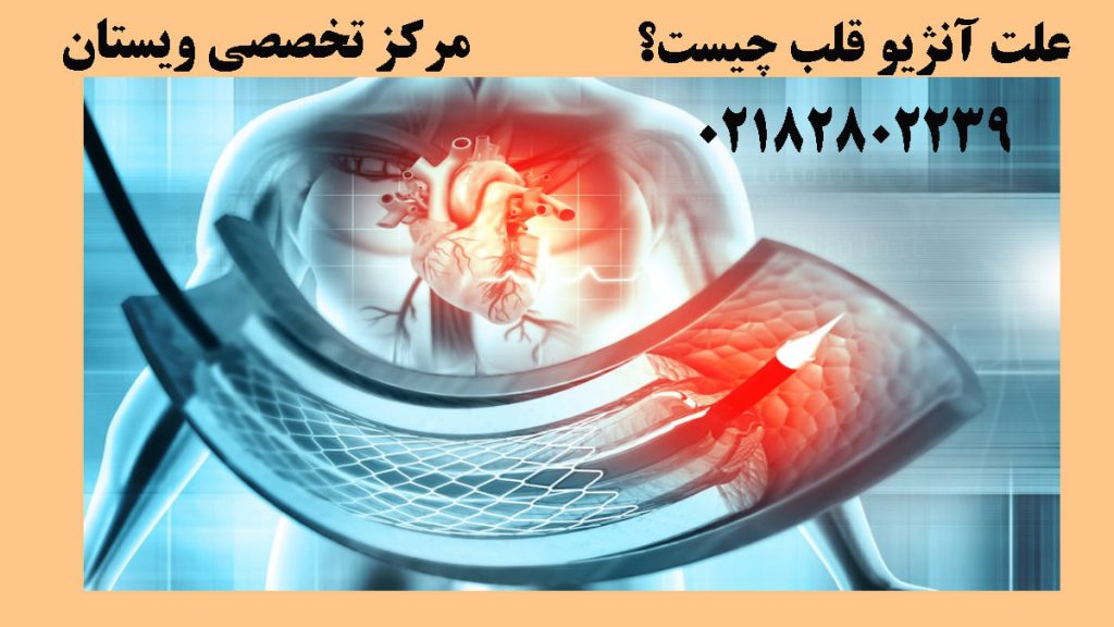یک دستگاه آنژیوگرافی در داخل رگهای قلب انسان-تصویر انیمیشنی است
