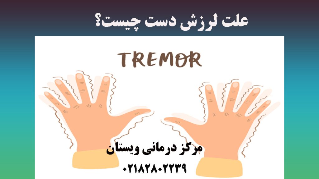 تصویر انیمیشنی از لرزش دست-نوشته : علت لرزش دست چیست؟ 
