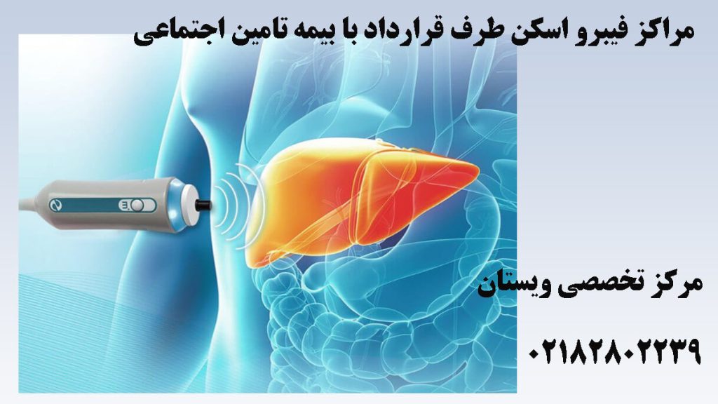 تصویر نمادین از دستگاه فیبرو اسکن در حال انجام فیبرو اسکن کبد