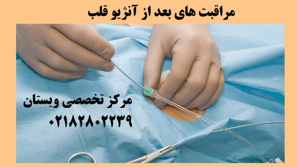 یک پزشک در حال انجام آنژیو قلب