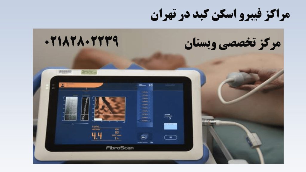 دستگاه و مانیتور فیبرو اسکن