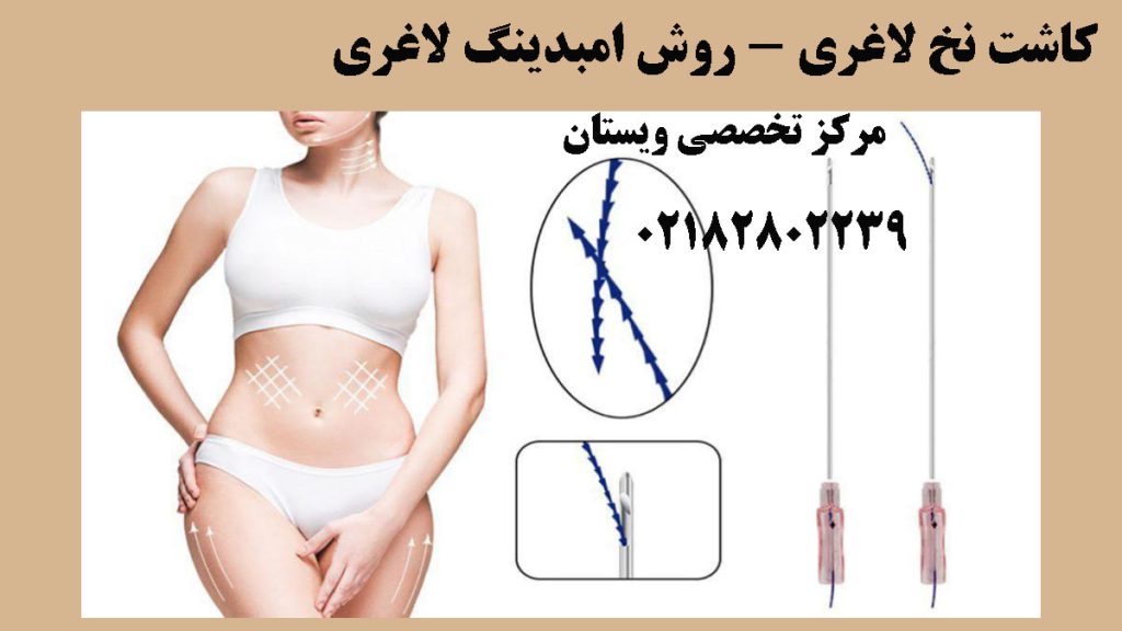 یک خانم برای نمایش امبدینگ لاغری روی بدنش خط کشی شده و چند سوزن امبدینگ