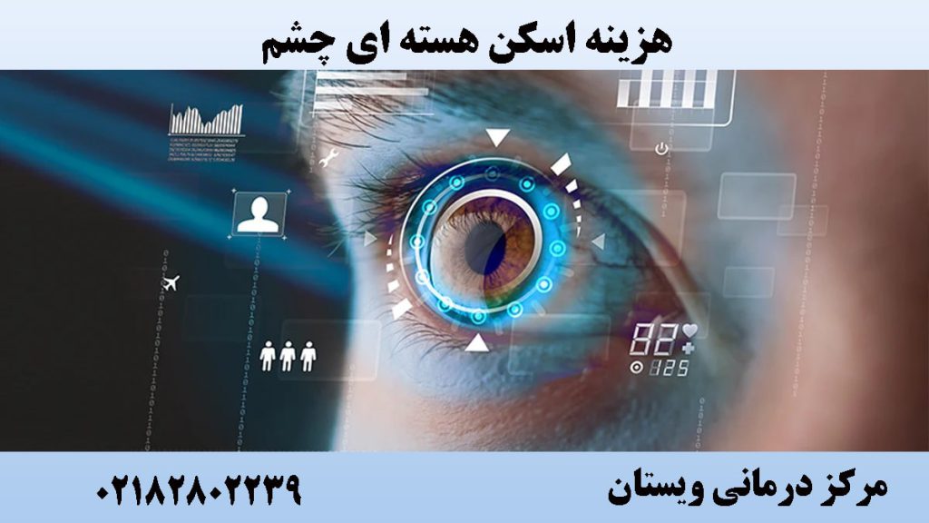 تصویر دیجیتالی از چشم-نوشته : هزینه اسکن هسته ای چشم 