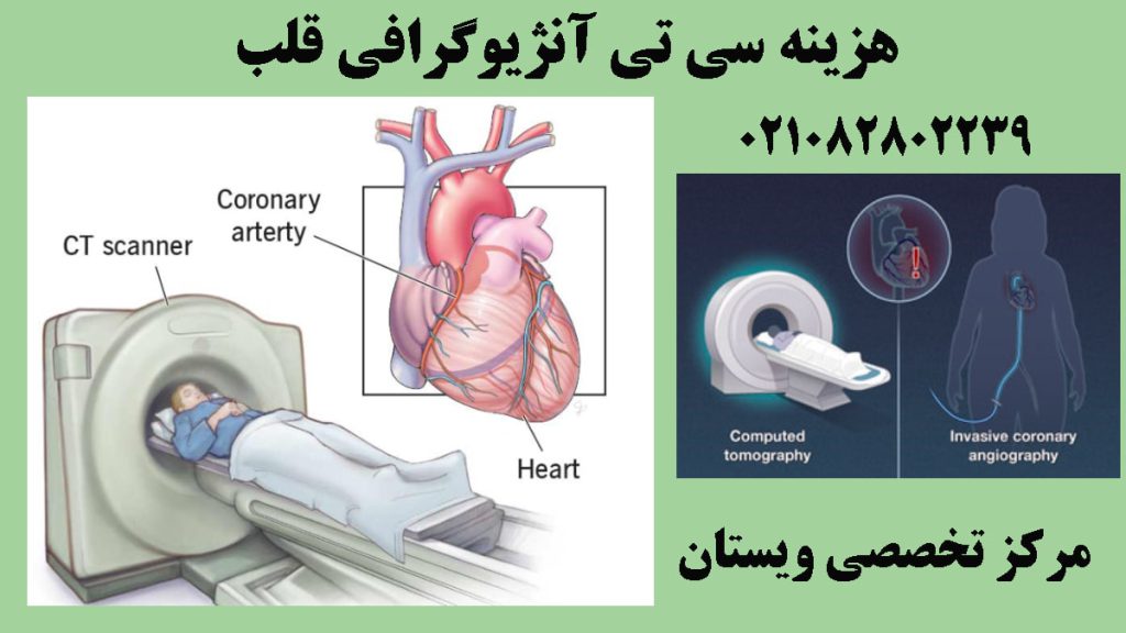 دو تصویر از انجام و نتیجه سی تی آنژیو-نوشته :هزینه سی تی آنژیوگرافی قلب 