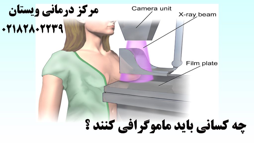 تصویر انیمیشنی از یک خانم در داخل دستگاه ماموگرافی-نوشته : چه کسانی باید ماموگرافی کنند ؟