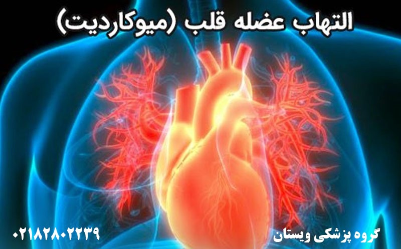 میوکارد قلب چیست؟