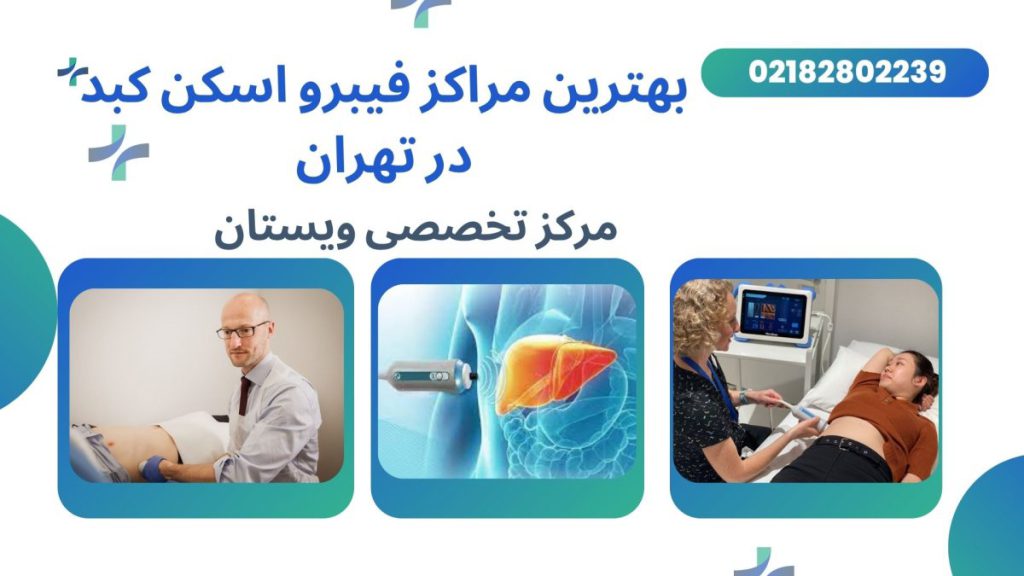 بهترین مراکز فیبرواسکن تهران