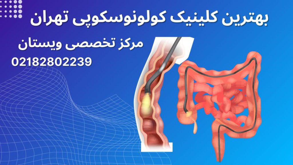کلینیک کولونوسکوپی روده انسان در حال کولونوسکوپی - نوشته : بهترین کلینیک کولونوسکوپی تهران