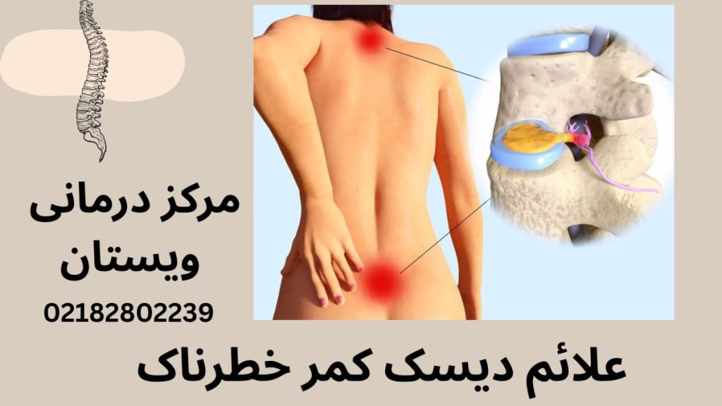تصویر انیمیشنی از یک شخص با درد در ناحیه کمر