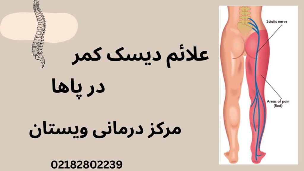 پاهای یک شخص برای نشان دادن علائم دیسک کمر در پاها