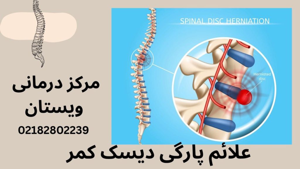 مهره های ستون فقرات در کنار یک تصویر کامل از ستون فقرات