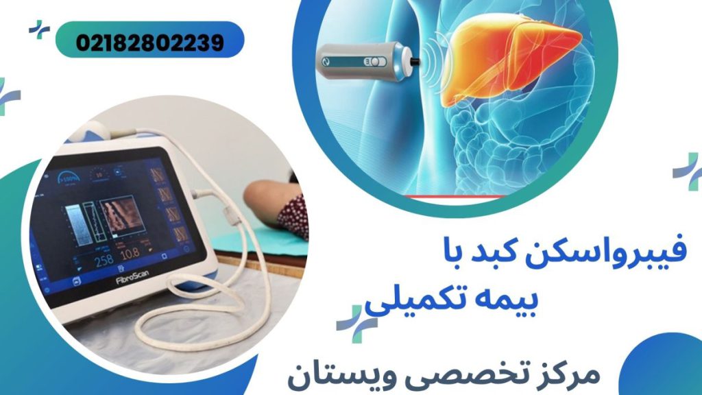 مراکز فیبرواسکن کبد طرف قرارداد با بیمه تکمیلی