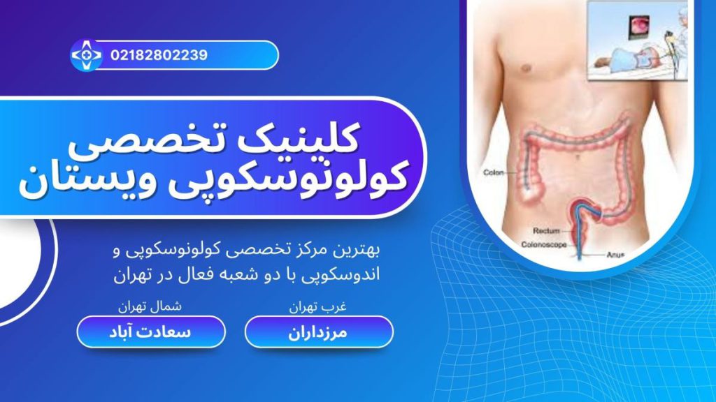 تصویر انیمیشنی از کولونوسکوپی روده