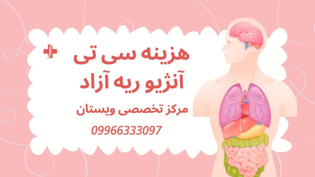 هزینه سی تی آنژیو ریه آزاد