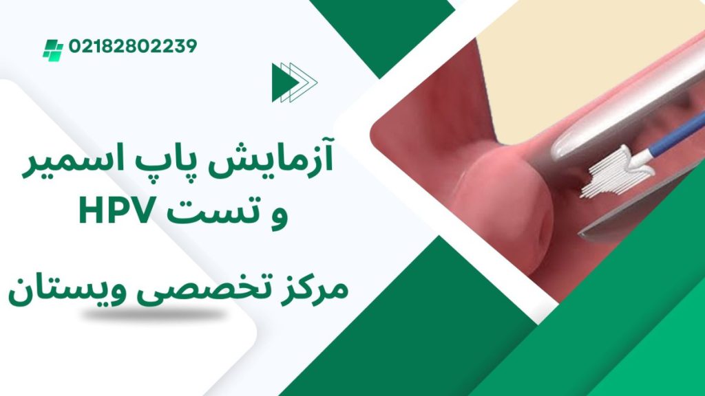 مرکز پاپ اسمیر ویستان