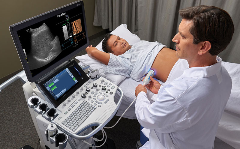 هنگام خواندن جواب فیبرو اسکن کبد، چه زمانی باید نگران باشیم؟ 
دکتر در حال انجام فیبرو اسکن کبد