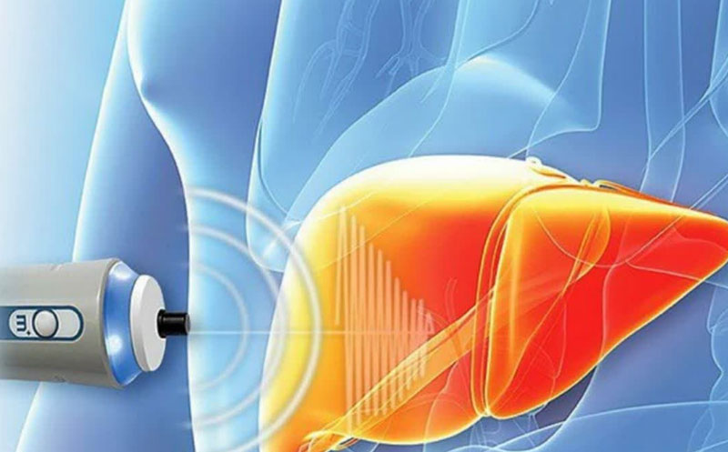 تفسیر جواب فیبرو اسکن کبد