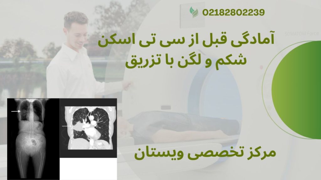 جواب سی تی اسکن شکم و لگن