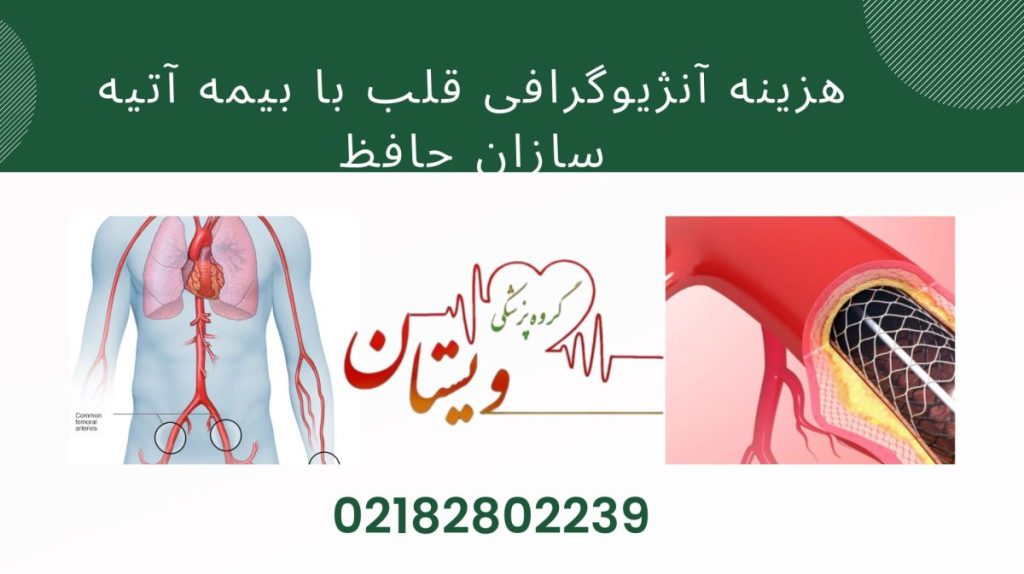 دو تصویر از آنژیوگرافی قلب