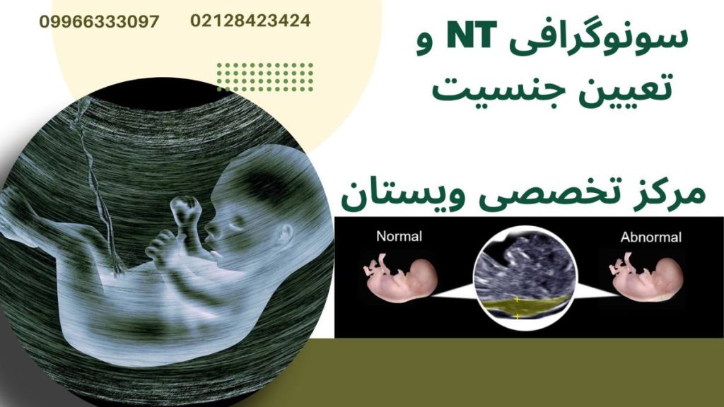 سونوگرافی NT دو تصویر از سونوگرافی -نوشته : سونوگرافی NT و تعیین جنسیت