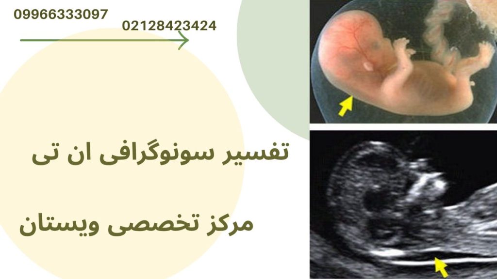 تفسیر سونوگرافی یک جنین در نتیجه سونوگرافی