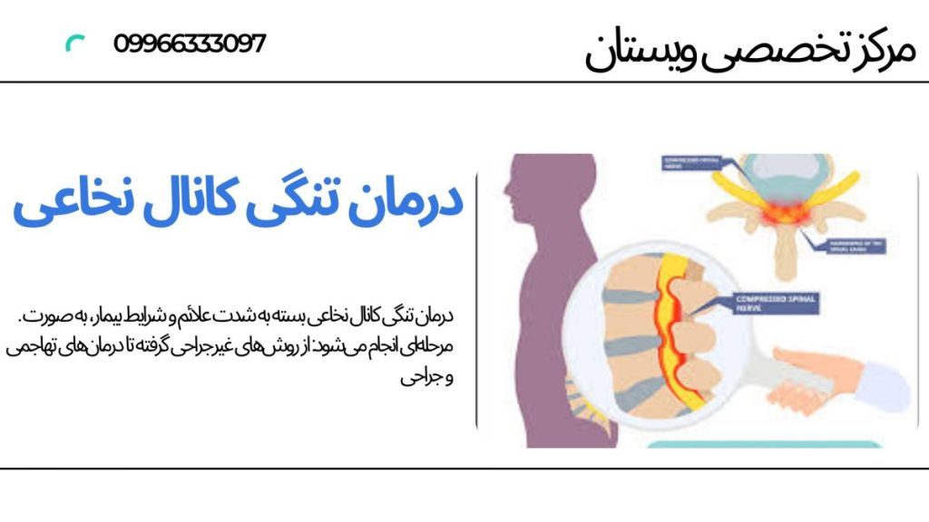 مهرههای ستون فقرات و نخاع یک شخص-نوشته : درمان تنگی کانال نخاعی
