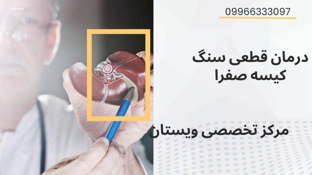 یک پزشک با مولاژ صفرا