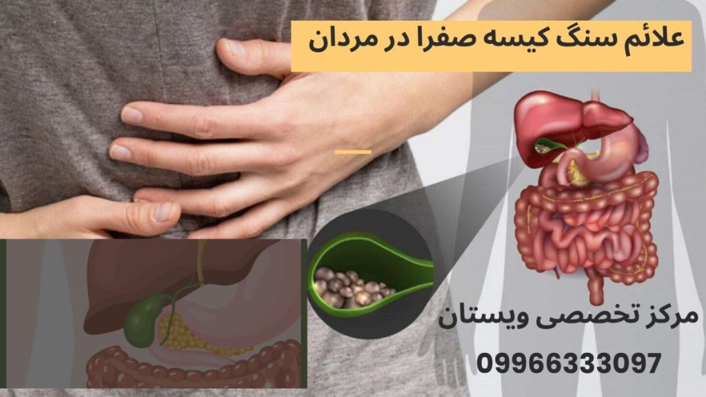 یک آقا با درد در قسمت صفرا به علت داشتن سنگ